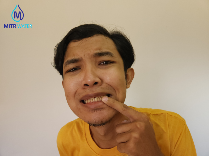 คราบฟลูออไรด์